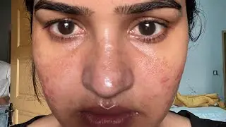 Tretinoin + Niacinamide Skincare Routine | Clear, Glowing Skin Without Irritation Beginner Friendly!