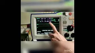 DESFIBRILADOR ZOLL - Funcionamiento básico