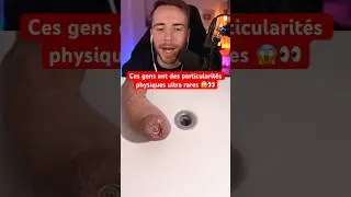 CES GENS ONT DES PARTICULARIT&Eacute;S PHYSIQUES ULTRA RARES 😱👀