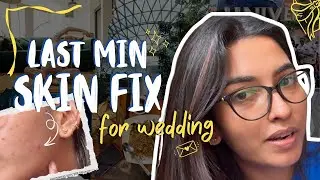Last-Minute Skin Fix Before a Wedding | My First Facial Experience | Saved Me in 1 Week