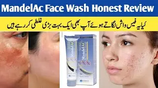 Jenpharm Mandelac Face wash Honest Review| Jenpharm face wash review|Face wash for dry skin