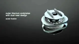 Lumbar disc prosthesis M6 L for minimally invasive surgery back surgery  | Instituto Clavel
