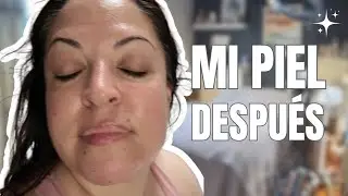 Me hice un facial | Autocuidado, café y día tranquilo