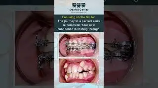 Best Dentist in Multan/ Best Dental Clinic in Multan