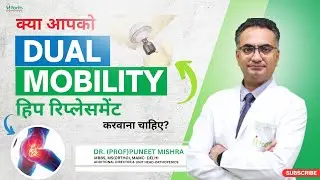 क्या आपको Dual Mobility हिप रिप्लेसमेंट करवाना चाहिए? | Hip replacement In Hindi | Dr. Puneet Mishra