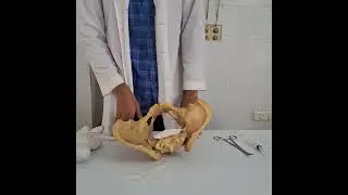 Active management of third stage  labour |procedure |
