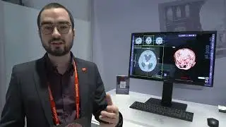 #RSNA2025 Demo: Glasses-free 3D visualization with Eonis 3D & Eonis Vision