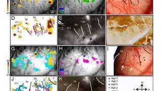 Visualizing the Complex Dynamics of Neuropathic Pain with Carl Saab, Ph.D - RSDSA