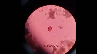 Food Parasite from Ants: Dicrocoelium dendriticum (lancet fluke) #worms #parasitology #microbiology