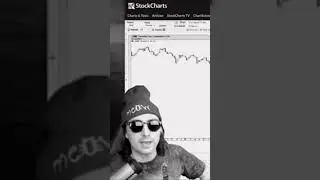 Why You Should buy GameStop Call Options (security analyst explanation) #gamestop