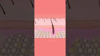 Medical Animation of Skin Clearance from Black Dots 🧑&zwj;⚕️ .#healthfield