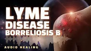 Lyme Disease (Borreliosis) B 🧬 Bioresonance Protocol | Targeted Frequency Support (BRT)