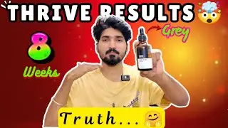 Thrive Grey Hair Serum Review🤠: My Honest Results After 8 weeks💀 