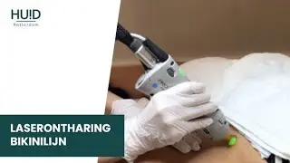 Laserontharing bikinilijn