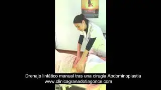 Drenaje linfático manual tras una cirugia abdominoplastia