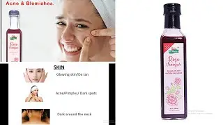 Introducing ROSE VINEGAR