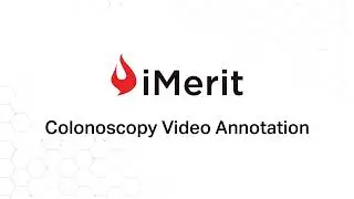 Colonoscopy Video Annotation for Pharma AI | iMerit