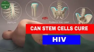 can stem cell transplant cure a patient of the HIV ?
