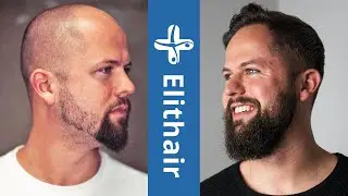 Elithair - Il tuo n° 1 per il trapianto di capelli