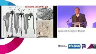 Stephen Bloom - Gut & Money, Customer Shrunk
