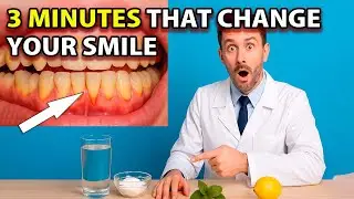 Teeth Whitening at Home in 3 Minutes. How to Naturally Whiten Yellow Teeth. 100% Effect