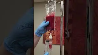 UPDATE: Stop Inflammation By This: O3UV Therapy.