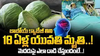 18-Year-Old Girl Dies&nbsp;After Eating Cabbage? Doctors Explain How It Attacks the Brain