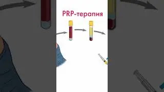 Если нет фолликулов? Процедура омоложения яичников. PRP-терапия