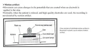 BASICS OF BIOMEDICAL INSTRUMENTATION - UNIT 1 - Recording problem