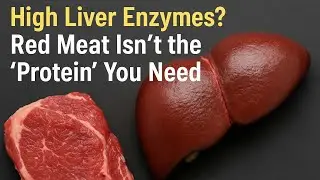 Protein for Liver Health&mdash;If You Pick Right&hellip; and Don&rsquo;t Overdo It