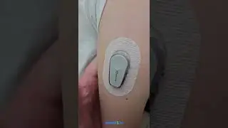 Dexcom G6 в Казахстане! Заказать на сайте Diabetiki1.kz