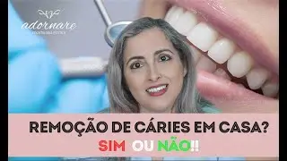 Como Tratar a Cárie em Casa?  É Possível?  - Dra. Cíntia Amorim - Adornare Odontologia