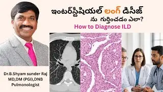 How to Diagnose Interstitial Lung Diseases Dr. B Shyam Sunder Raj | MD,DM(PGI) DNB Pulmonologist .