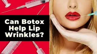 Can Botox help Lip Wrinkles?  The true answer to this popular question is important to understand.