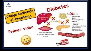 DIABETES TIPO 2  DEFINICION   FISIOPATOLOGIA  COMPRENDIENDO LA ENFERMEDAD