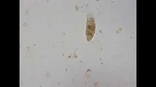 Condylostoma and a Mytilina.avi