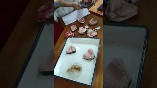 ORAL PATHOLOGY BDS 3RD YEAR PRACTICAL EXAM SPOTTING (revision)