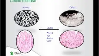 Webinar: Nutrigenetics - The Science of How our Genes Affect our Nutrition Needs