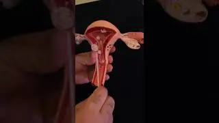 how do we get a uterine endometrial biopsy?