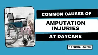 Common Causes of Amputation Injuries at Daycare