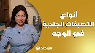 أنواع التصبغات الجلدية في الوجه | كاريزما  - Carisma