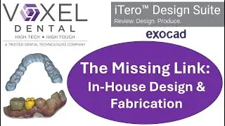 iTero Design Suite &mdash; недостающее звено для собственных нужд в области фрезерования и печати.