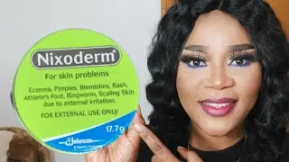 Affordable and cheap way to get rid of fungal acne/Nixoderm for skin Problems #skincare #skin #acne
