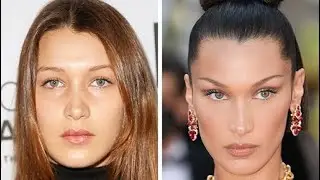 Plastic Surgery: Worth It?!