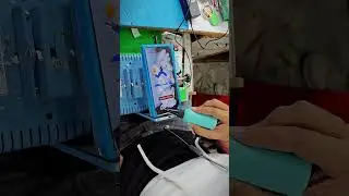 Black Dot Remove #motivation #upsc #sad #love #subscribe #smartphone #shortsfeed #viralshorts #tech