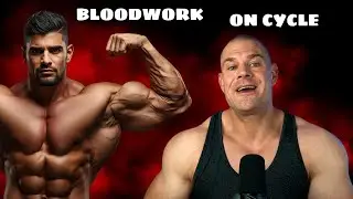 Don't Skip Frequent Bloodwork On Cycle...  + TRT Clinics