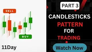 11Day||Candlesticks Pattern||Part 3 ||Free Trading Course 