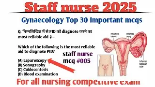 staff nurse gynaecology top 30 important mcqs,staff nurse multiple choice questions staff nurse exam