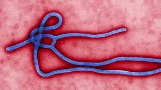 Ebola defense options: Quarantine, isolation and self-monitoring