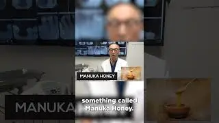 How to Heal A Sore Mouth at Home | Doctor's Tricks👨&zwj;⚕️🔍